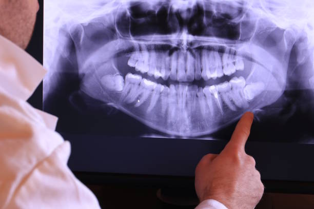 Best Emergency Gum Treatment in Big Lake, TX