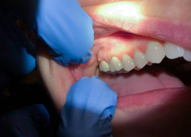 Best Emergency Denture Repair in Big Lake, TX
