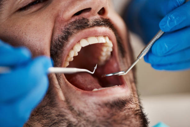 Best Emergency Dental Care for Broken or Chipped Teeth in Big Lake, TX